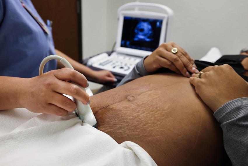 Dr. Ericka Jaramillo does an ultrasound on a patient from Austin, Texas, before her surgical abortion at Trust Women clinic in Oklahoma City, on Dec. 6, 2021.